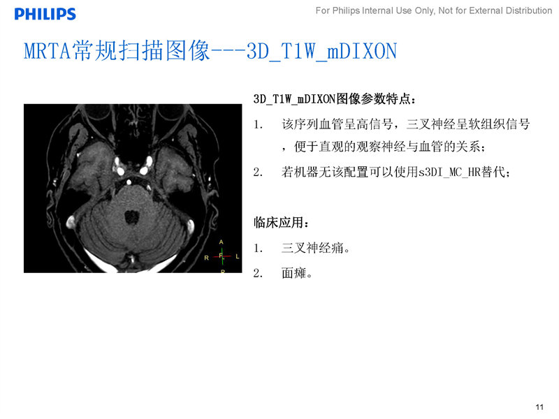 华山医院新一代“摄像”磁共振神经临床研究项目启动