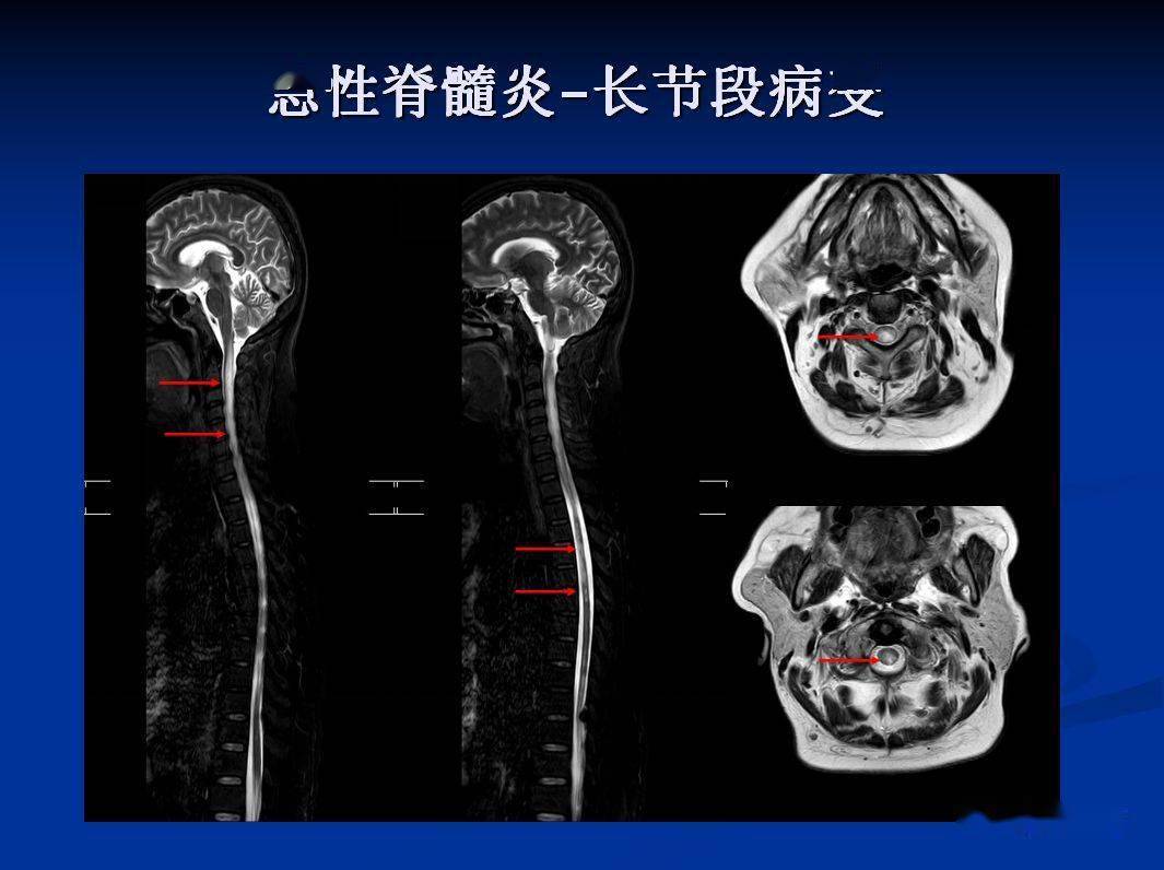 华山医院新一代“摄像”磁共振神经临床研究项目启动